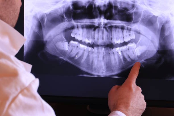 Best 24-Hour Emergency Dentist in Port Arthur, TX